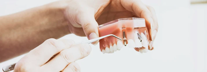 Dentist Biddeford ME Dental Practitioner Pointing at a Model of Upper Teeth with a Tool Dental Practitioner Pointing at a Model of Upper Teeth with a Tool
